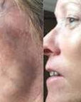 NEUROTRIS DYNAMIC MICROCURRENT FACE/NECK PACKAGE