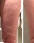 NEUROTRIS BODY PACKAGE